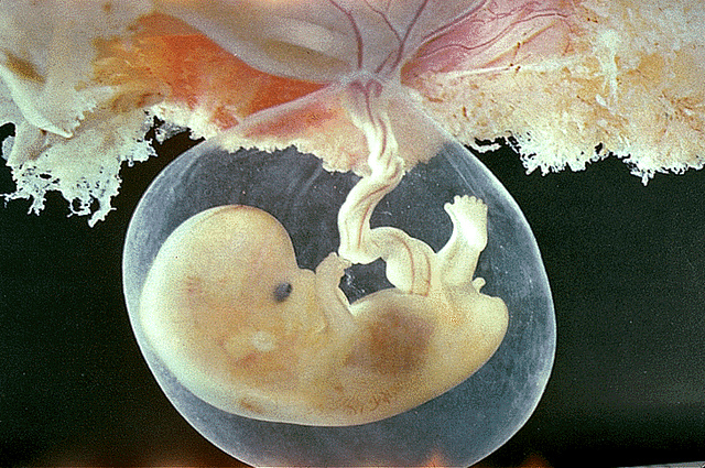 胎盤